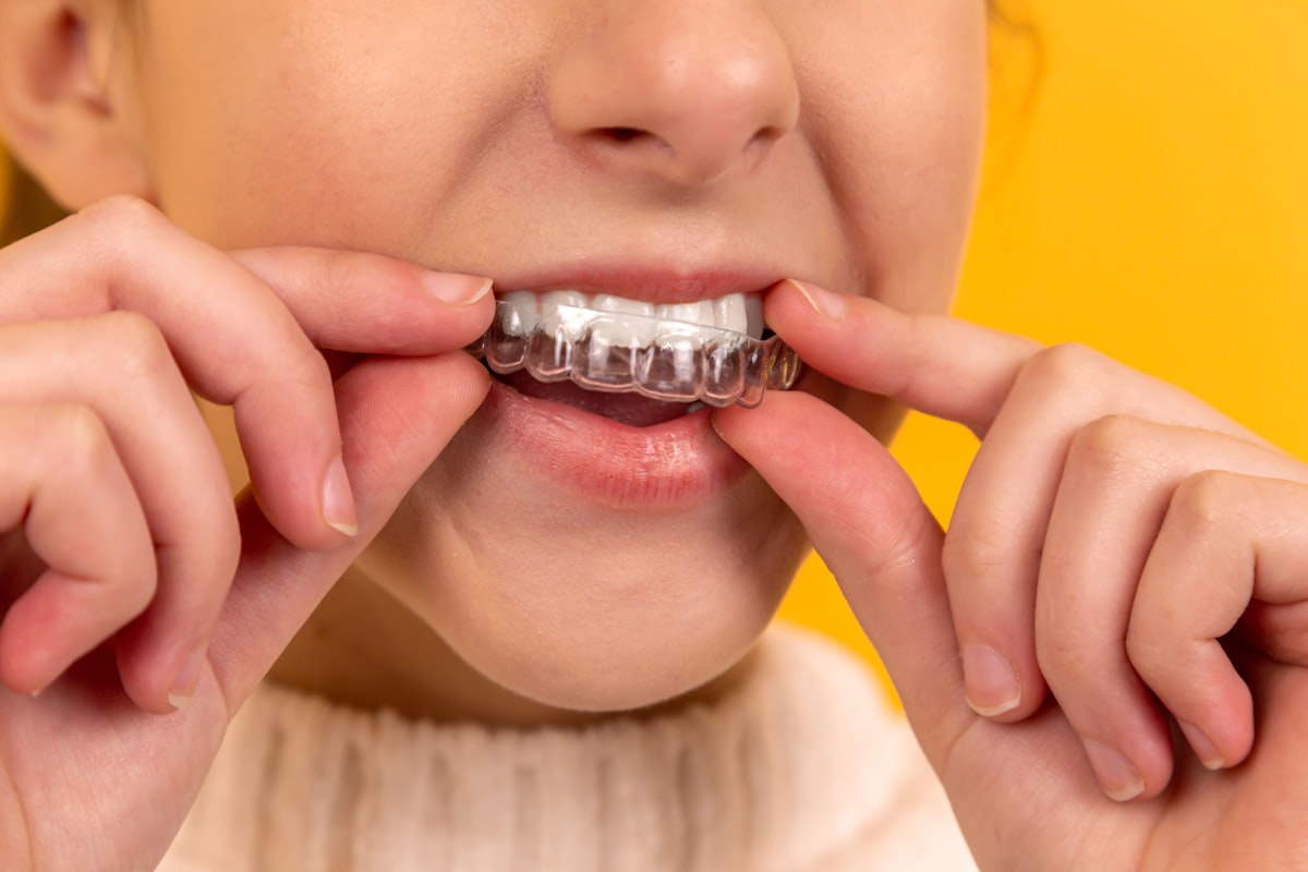 Invisalign Clear Aligners Orthodontics